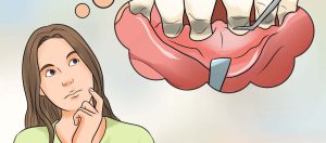 دلیل اصلی خارش لثه چیست؟