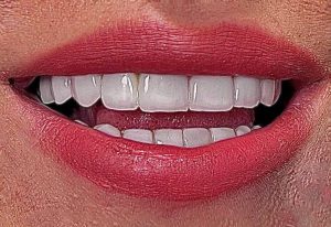لبخند هالیوودی در زعفرانیه
