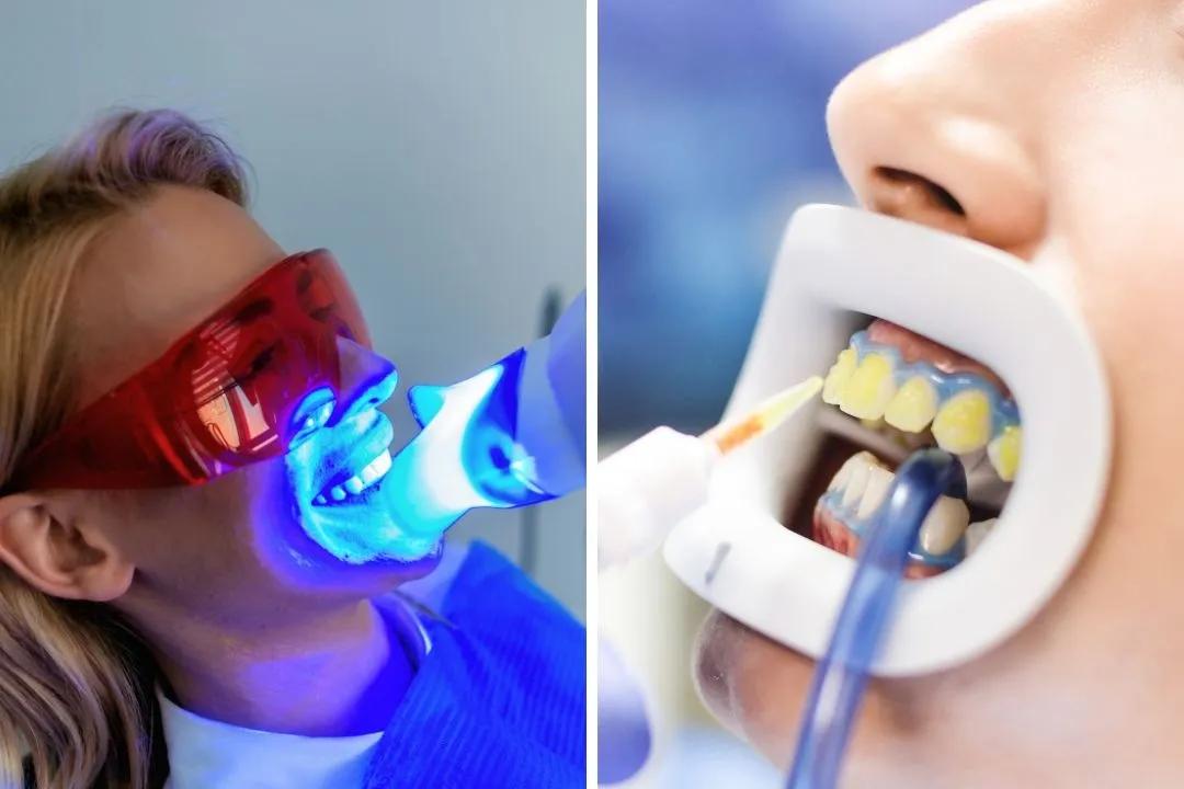 بلیچینگ در چه مواردی استفاده می شود؟