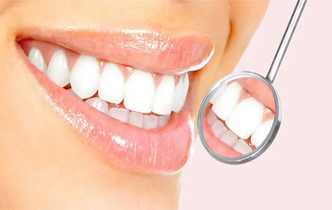 ۶ تفاوت بین لمینت دندان و کامپوزیت
