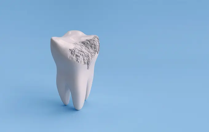 راه‌های درمان شکستگی دندان