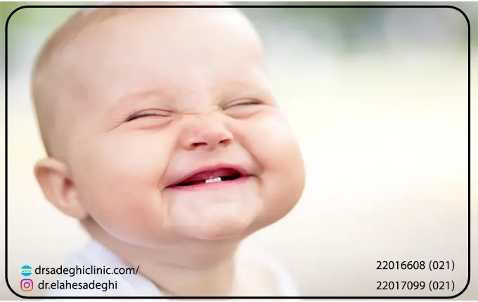 مواد غذایی مناسب برای حفظ سلامت دندان های شیری کودکان