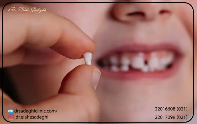 دندان شیری کودکان