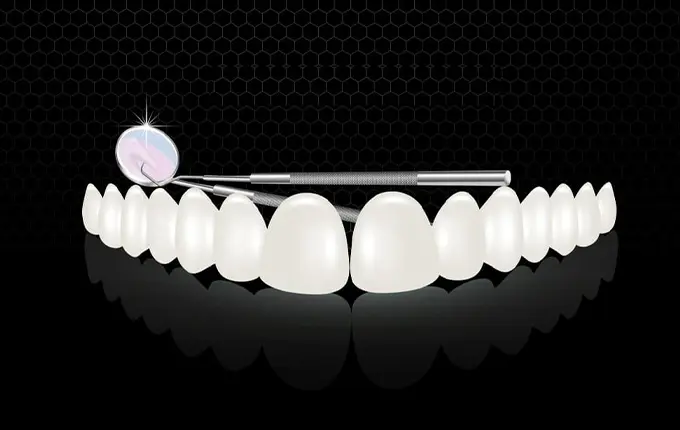 روکش دندان فوری چیست؟