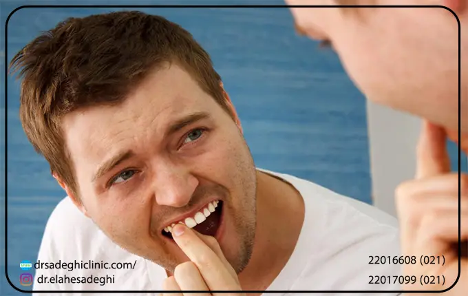 درمان های خانگی برای لق شدن دندان ها