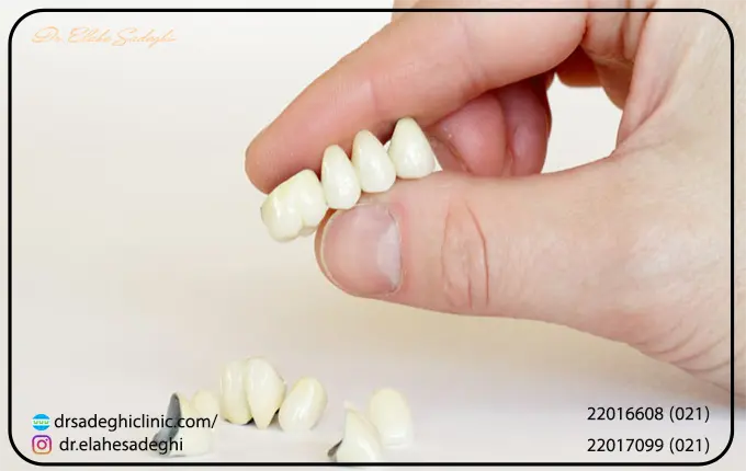  علائم لق شدن دندان در بزرگسالی