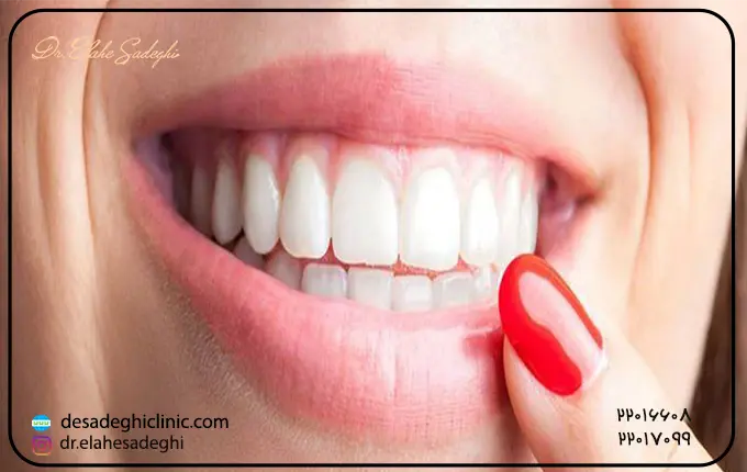 افزایش اندازه لثه