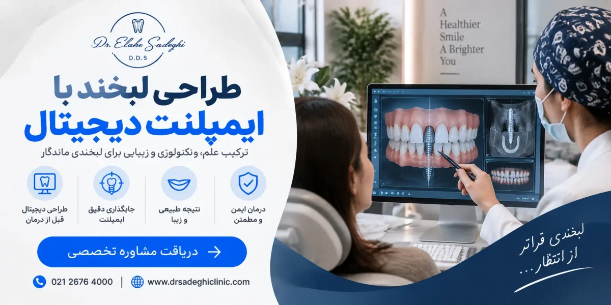 طراحی لبخند با ایمپلنت دیجیتال