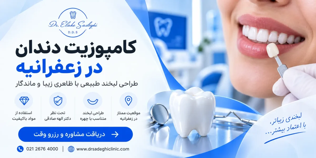 کامپوزیت در شمال تهران و زعفرانیه