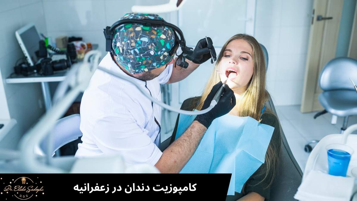 کامپوزیت دندان در زعفرانیه
