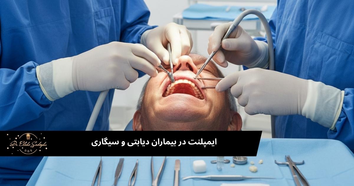 ایمپلنت در بیماران دیابتی و سیگاری: آیا امکان‌پذیر است؟