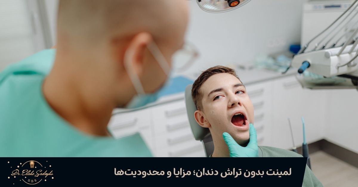 لمینت بدون تراش دندان
