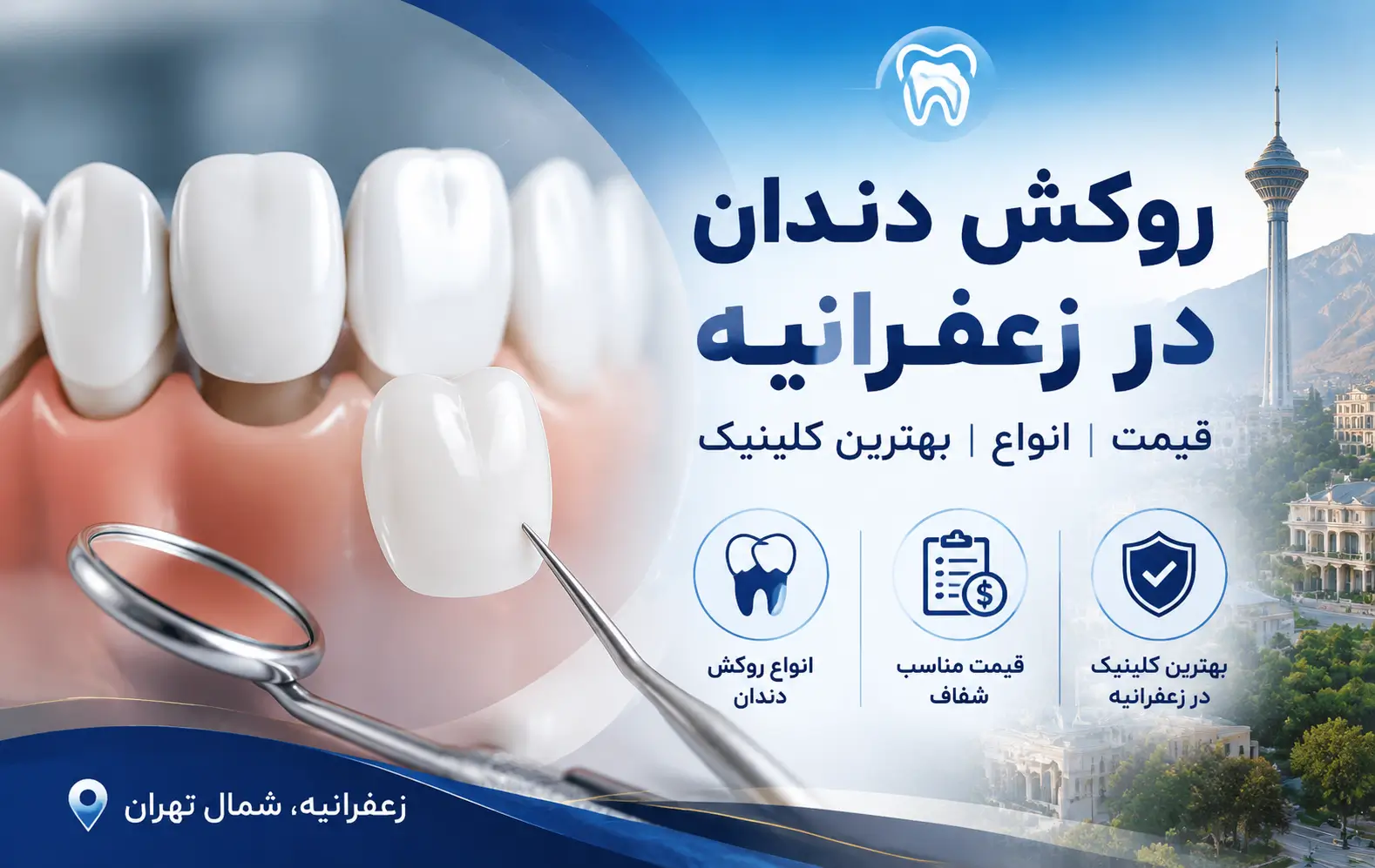 روکش دندان در زعفرانیه در دندانپزشکی دکتر صادقی