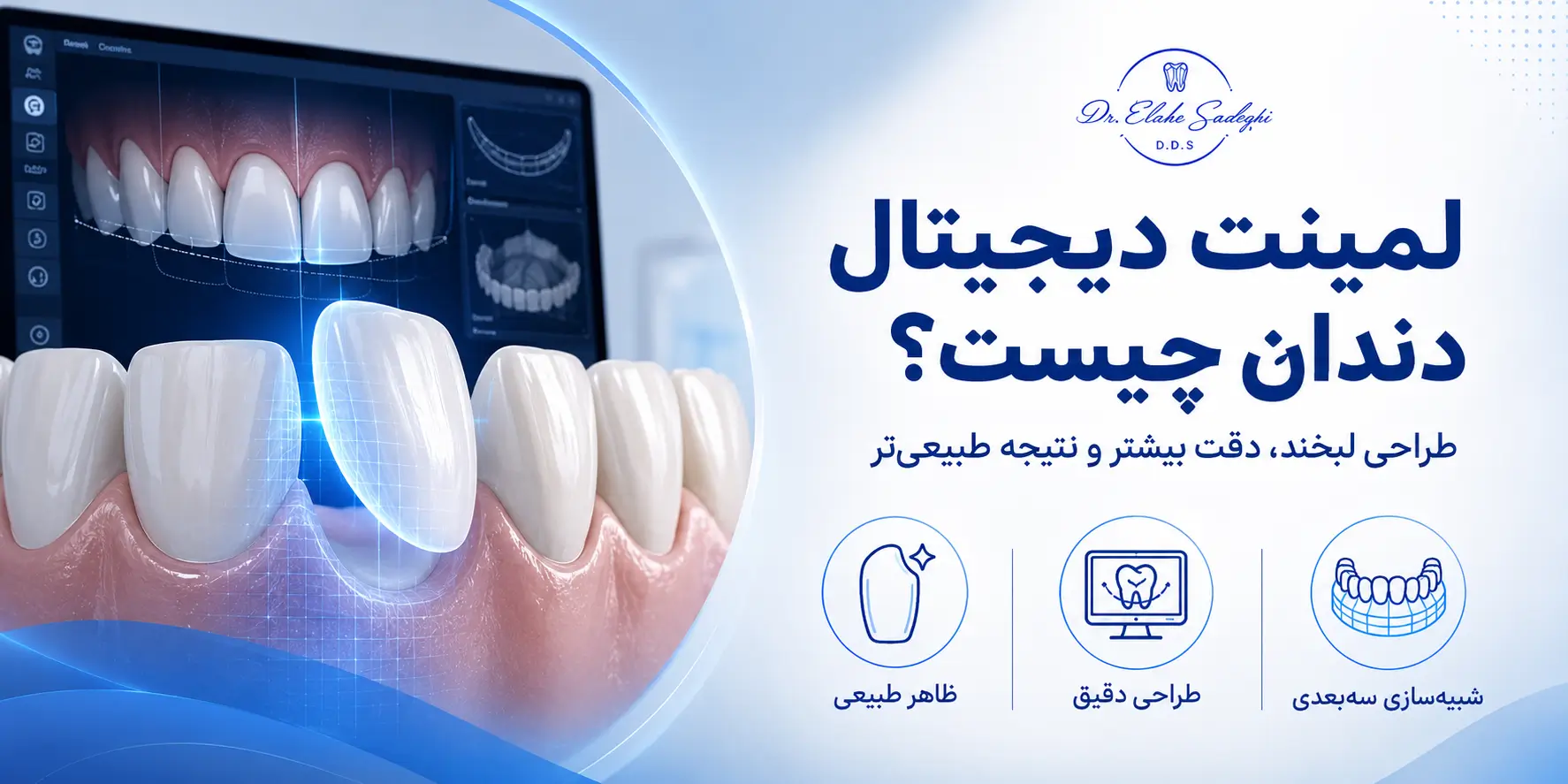 لمینت دیجیتال